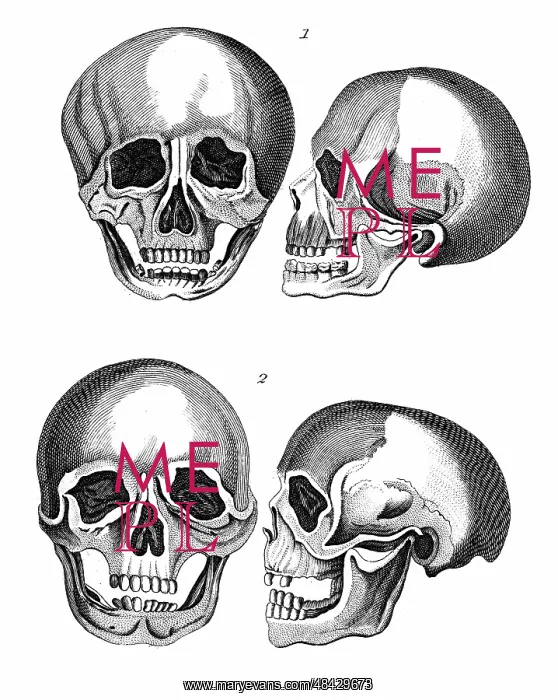 : 1: Germanic skull with all the marks of a European : 1: Germanic skull with all the marks of a European