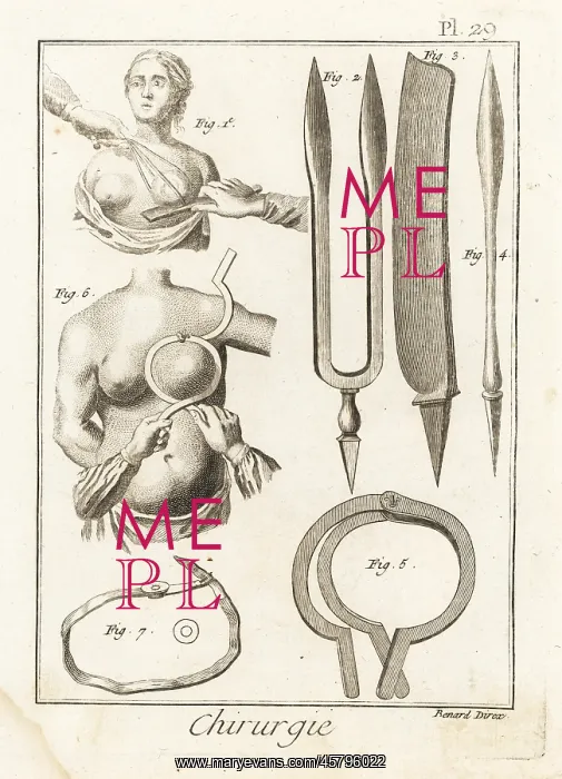 : 18th century mastectomy equipment : 18th century mastectomy equipment