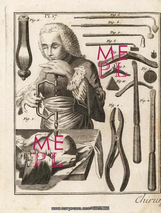 : 18th century surgeon performing a trepanning : 18th century surgeon performing a trepanning