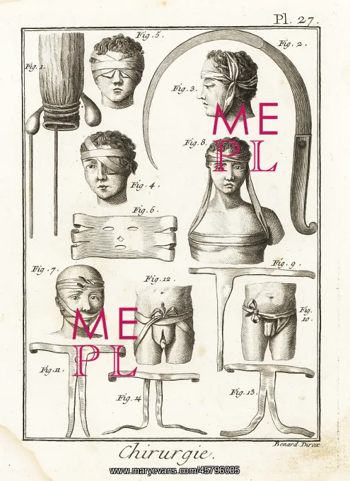 : 18th century surgical equipment : 18th century surgical equipment