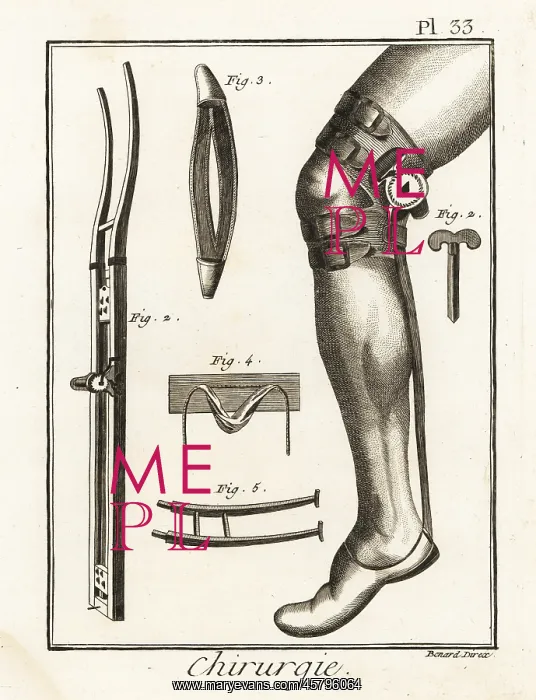 : 18th century surgical knee pad and dislocation machine : 18th century surgical knee pad and dislocation machine