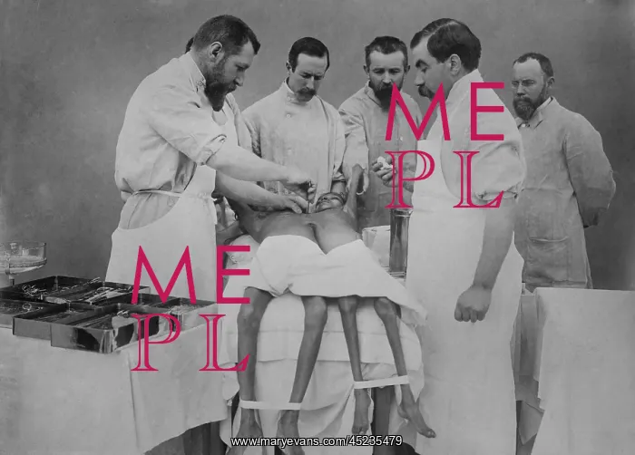 : 1912 operation separating young Indian conjoined ? : 1912 operation separating young Indian conjoined ?