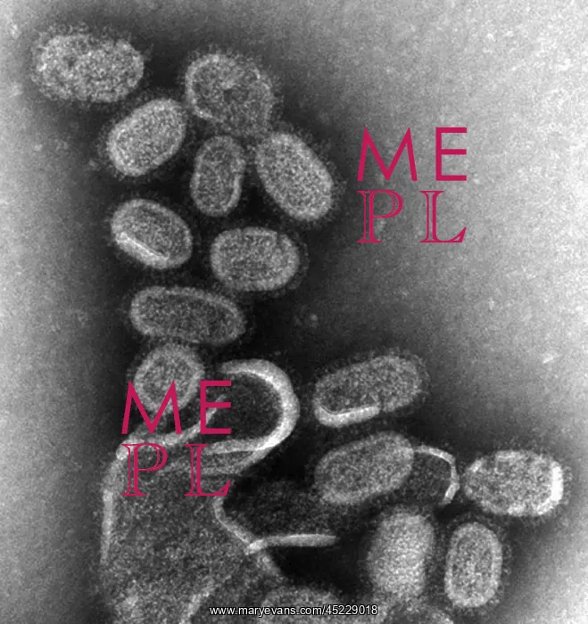 : 1918 influenza virions (virus particles).? : 1918 influenza virions (virus particles).?
