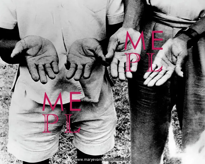 : 1959 - Modern Miracle? - His Hands Have Been Altered : 1959 - Modern Miracle? - His Hands Have Been Altered