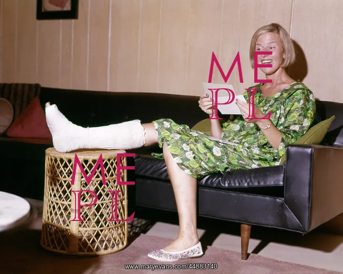 : 1960s Woman With Broken Leg In : 1960s Woman With Broken Leg In