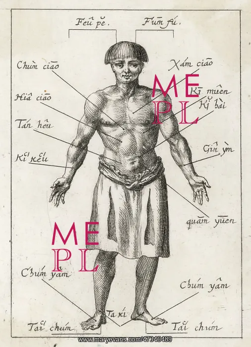 : ACUPUNCTURE IN 17TH CENT : ACUPUNCTURE IN 17TH CENT