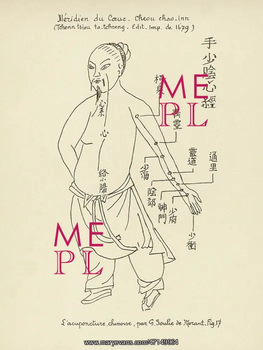 : Acupuncture -- the Heart : Acupuncture -- the Heart