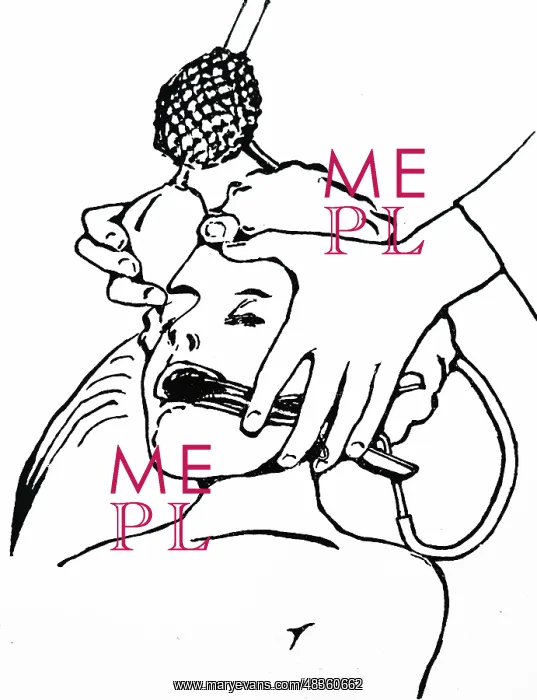 : Administering chloroform using a Junker's inhaler: : Administering chloroform using a Junker's inhaler: