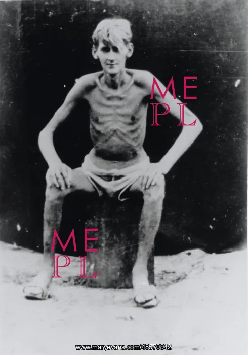 : Allied prisoner of war in a poor physical condition : Allied prisoner of war in a poor physical condition