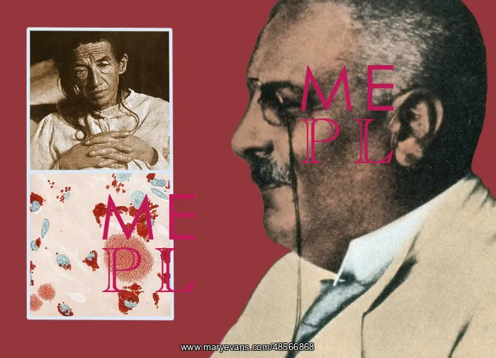 : Alois Alzheimer and Auguste Deter : Alois Alzheimer and Auguste Deter