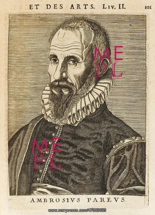 : AMBROISE PARE : AMBROISE PARE