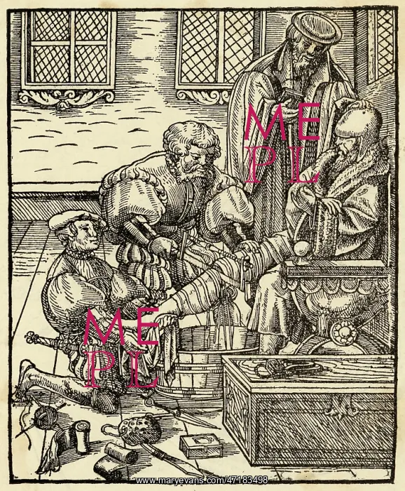  : AMPUTATING A LEG C16