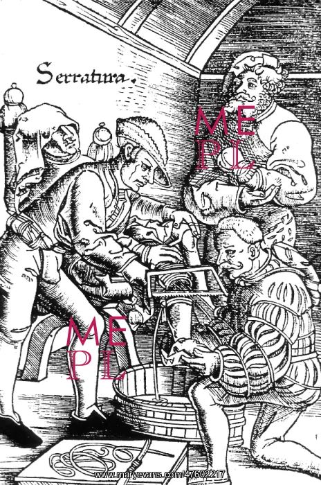 : Amputation, 1517 : Amputation, 1517