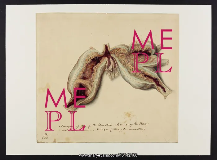 : Aneurysm of One of the Mesenteric Arteries (Horse) : Aneurysm of One of the Mesenteric Arteries (Horse)