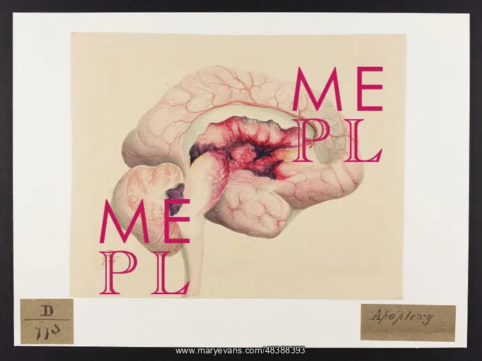 : Apoplexy. Longer caption on verso : Apoplexy. Longer caption on verso