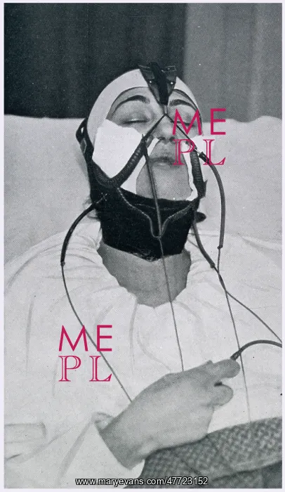 : Apparatus for the Removal of the Double Chin 1927 : Apparatus for the Removal of the Double Chin 1927