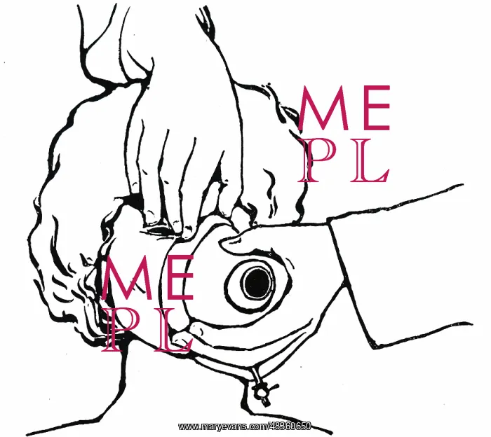 : Applying face-piece for the administration of : Applying face-piece for the administration of