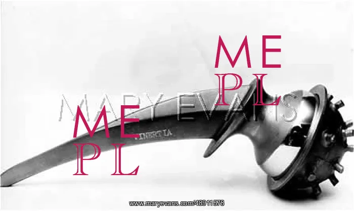 : ARTIFICAL JOINT : ARTIFICAL JOINT