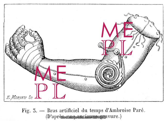 : Artificial arm by Ambroise Pare : Artificial arm by Ambroise Pare