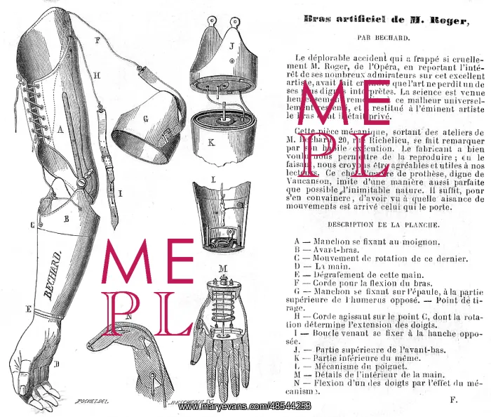 : Artificial arm by Bechard : Artificial arm by Bechard