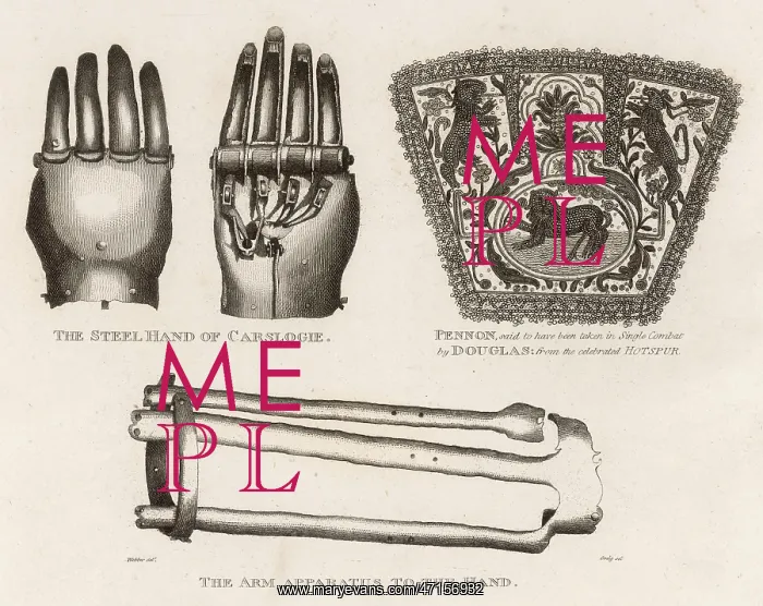 : Artificial hand and arm apparatus : Artificial hand and arm apparatus