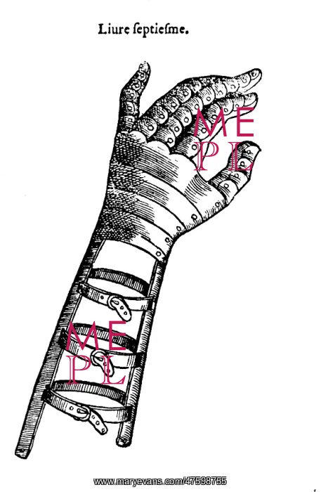 : Artificial Hand Designed by Ambroise Par?, 1564 : Artificial Hand Designed by Ambroise Par?, 1564