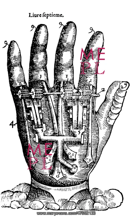 : Artificial Hand Designed by Ambroise Par?, 1564 : Artificial Hand Designed by Ambroise Par?, 1564