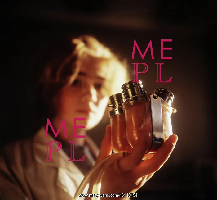 : Artificial heart, 1973 : Artificial heart, 1973