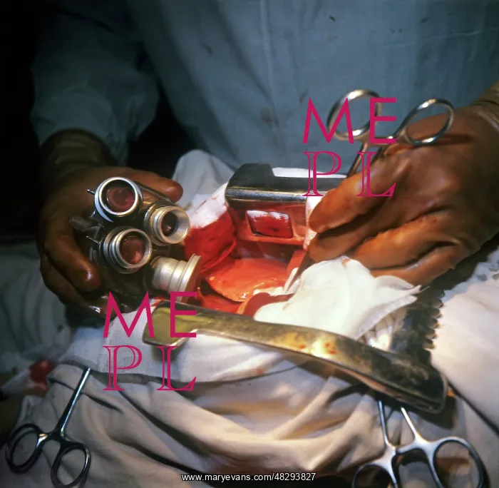 : Artificial heart, 1974 : Artificial heart, 1974