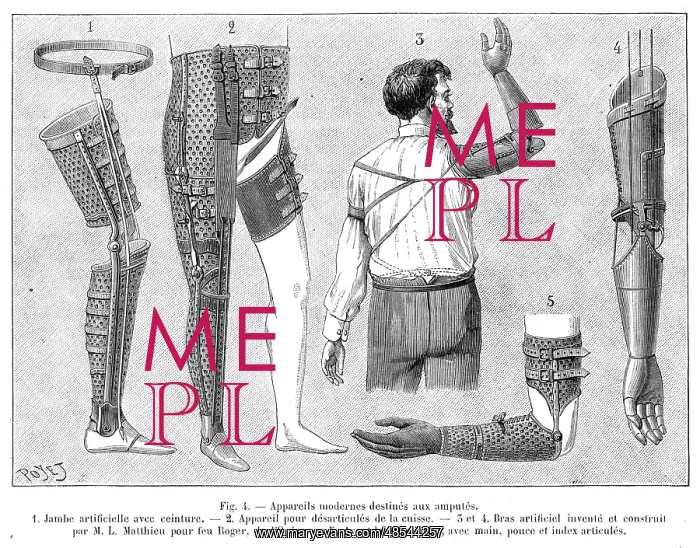 : Artificial leg and arm : Artificial leg and arm