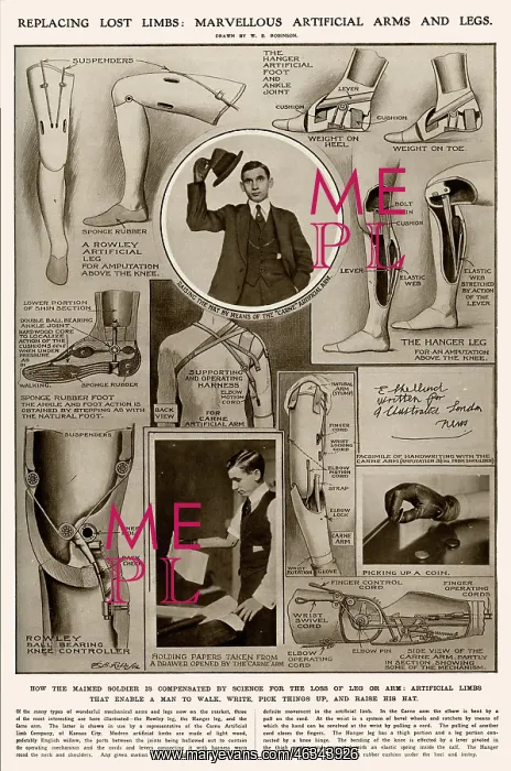 : Artificial limbs : Artificial limbs