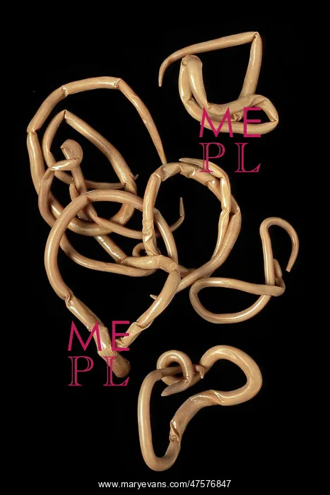 : Ascaris lumbricoides, human roundworm : Ascaris lumbricoides, human roundworm