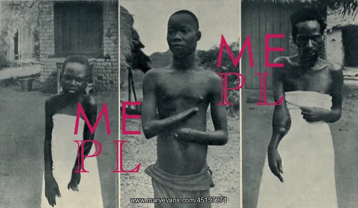 : Atrocities of the Rubber Slavery in the ? : Atrocities of the Rubber Slavery in the ?