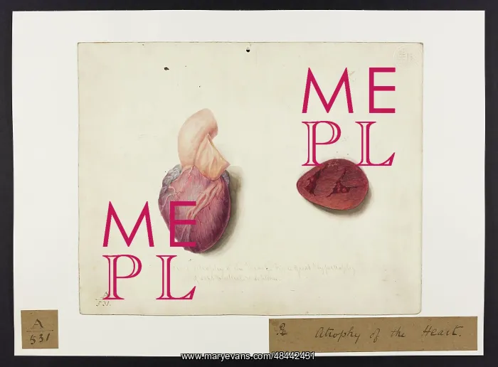 : Atrophy of the Heart : Atrophy of the Heart