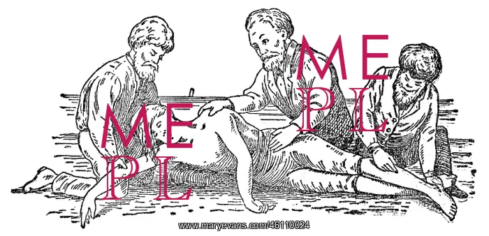 : Attempt at resuscitation according to Marshsall Hall, 1902 : Attempt at resuscitation according to Marshsall Hall, 1902