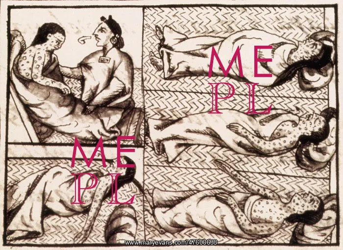 : Aztecs Dying of Smallpox : Aztecs Dying of Smallpox
