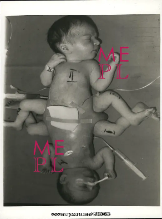 : Babies - Children - Multiple Births : Babies - Children - Multiple Births