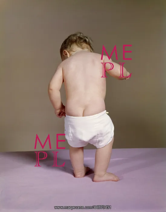  : Baby With Droopy Diaper