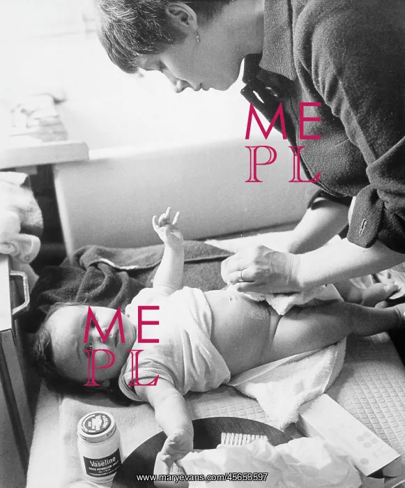 : BABY HAVING NAPPY CHANGE : BABY HAVING NAPPY CHANGE