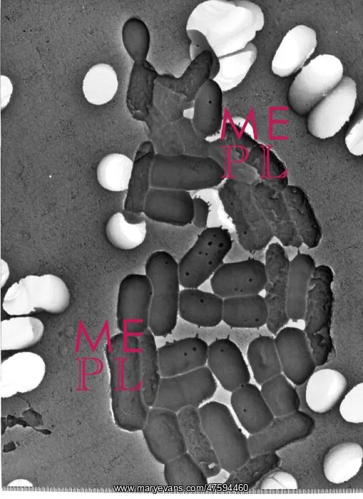 : Bacillus sp. bacteria : Bacillus sp. bacteria