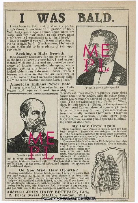 : BALDNESS CURED 1919 : BALDNESS CURED 1919