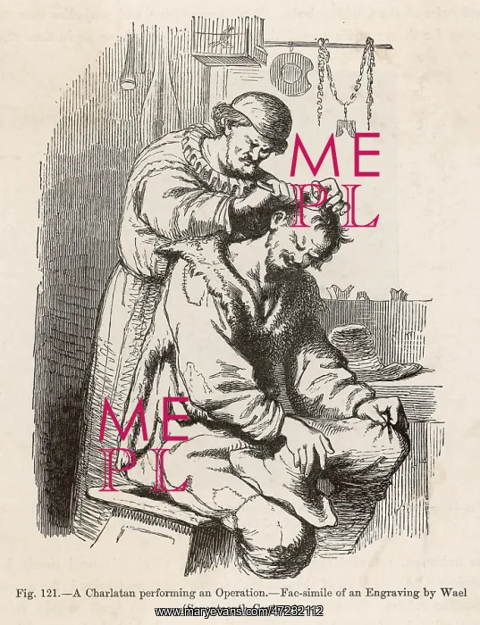  : BARBER-SURGEON OPERATION