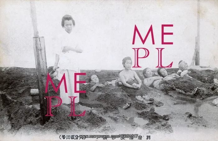 : Beppu - Sand Baths at the Hot Springs : Beppu - Sand Baths at the Hot Springs