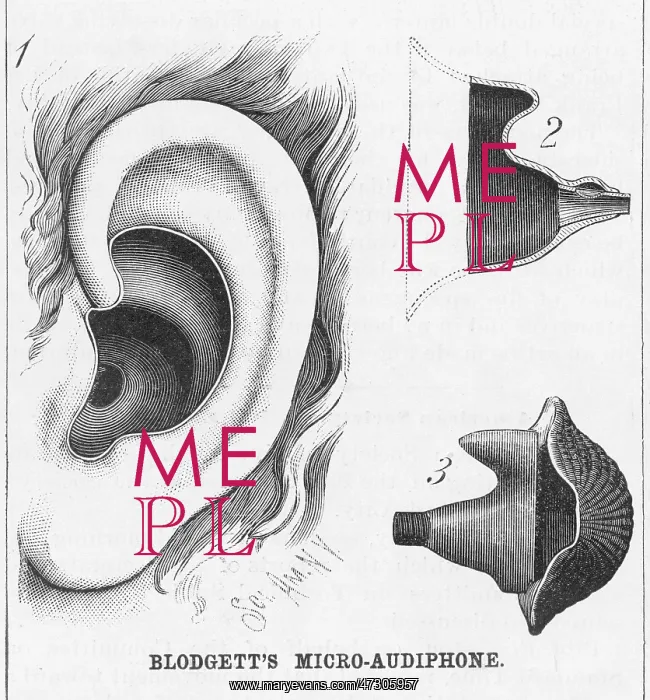: Blodgett's Hearing Aid : Blodgett's Hearing Aid