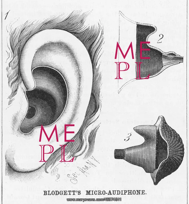: Blodgett's Hearing Aid : Blodgett's Hearing Aid