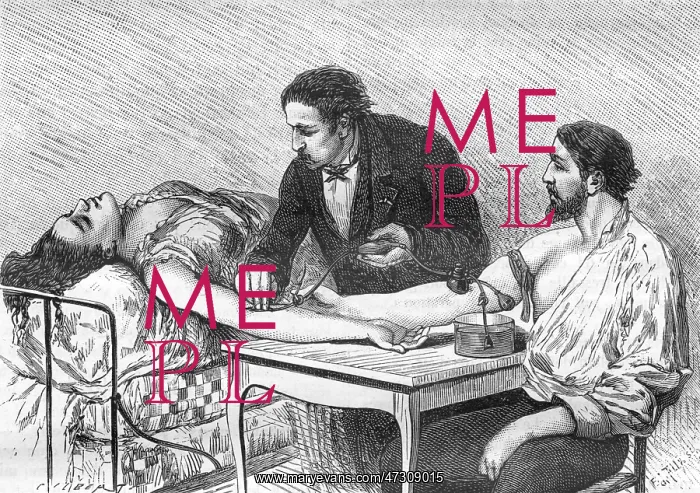  : Blood Transfusion - 1882