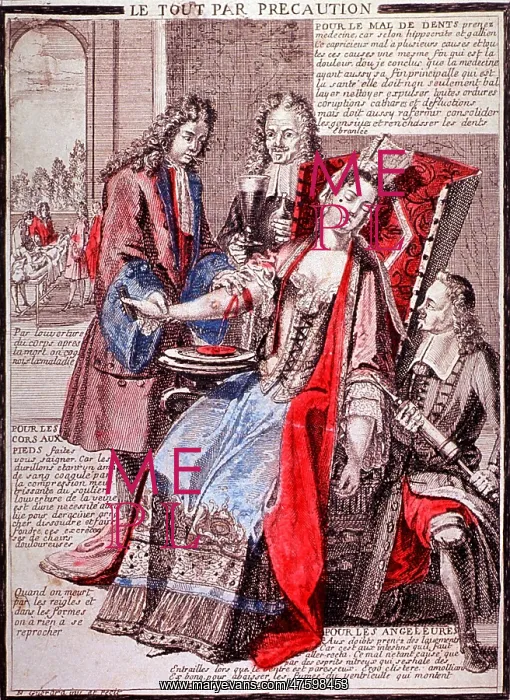 : Bloodletting, 17th Century : Bloodletting, 17th Century
