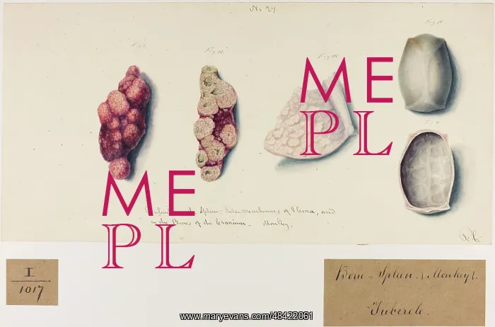 : Bone and Spleen Tubercles (Monkey) : Bone and Spleen Tubercles (Monkey)