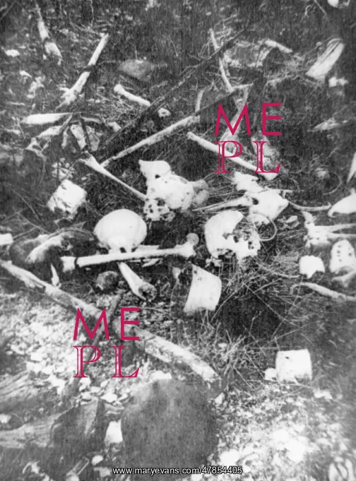  : Bones 1916