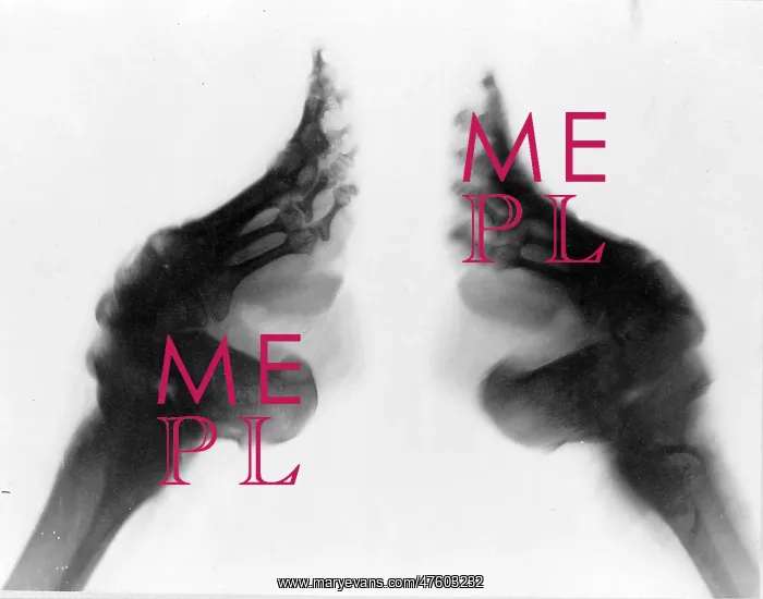: Bound Feet, X-Ray : Bound Feet, X-Ray